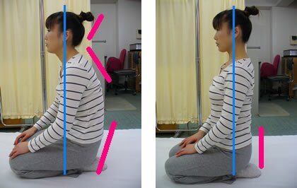 首の痛みと姿勢